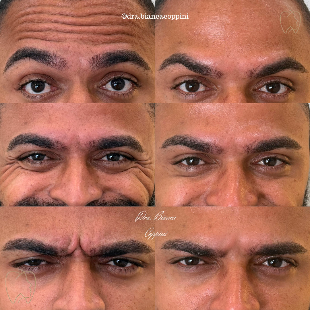 Antes e depois - Caso 2