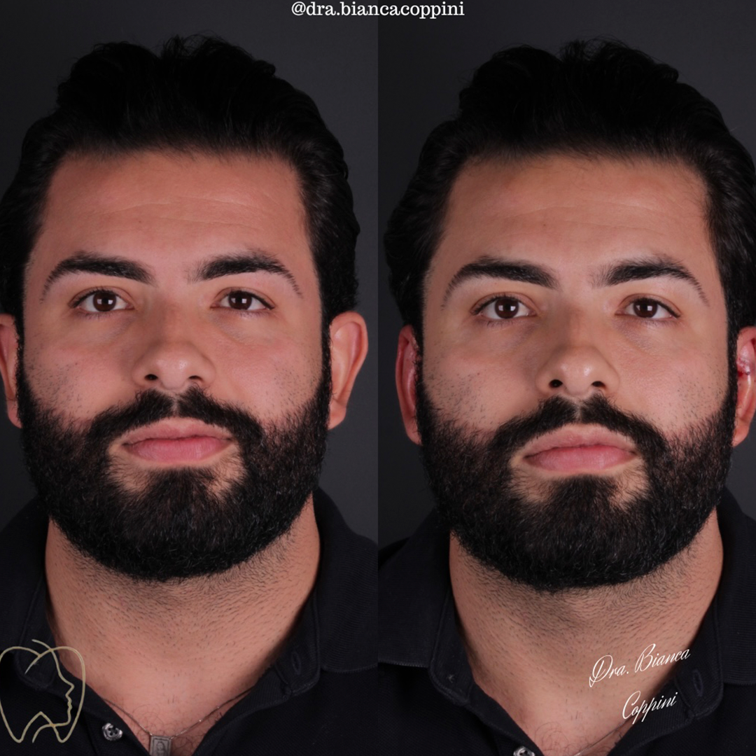 Antes e depois - Caso 3