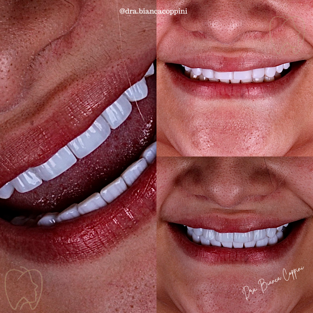 Antes e depois - Caso 4