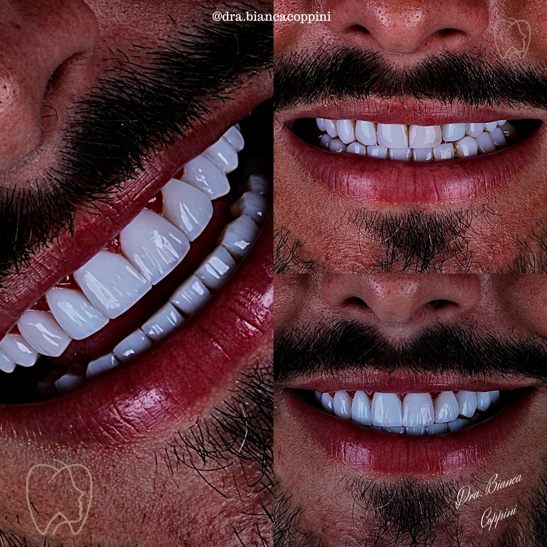 Antes e depois - Caso 5