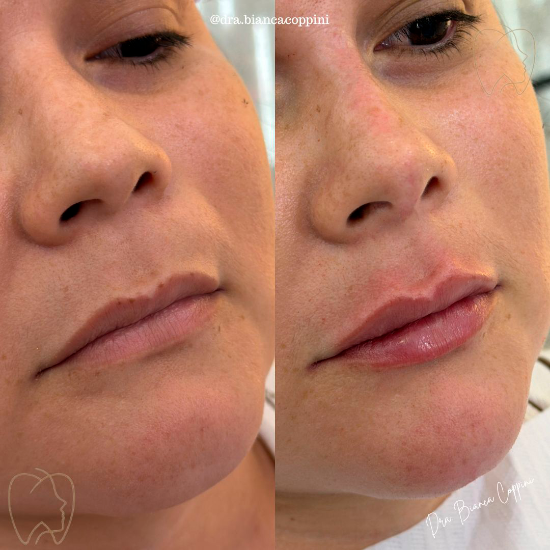 Antes e depois - Caso 7