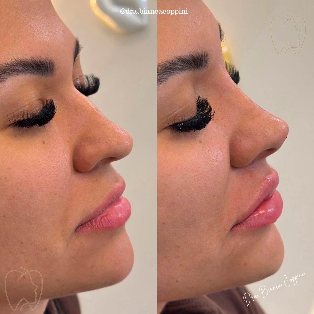 Antes e depois - Caso 8