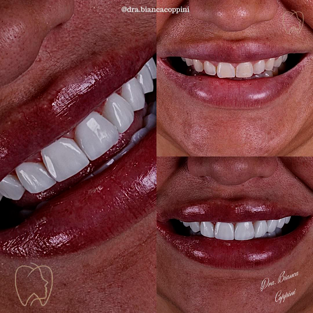 Antes e depois - Caso 9